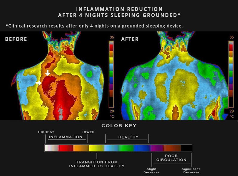 The Science Behind Grounding: How Connecting with Nature Can Reduce Inflammation - Earth Ground